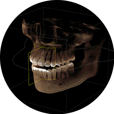 Digital X-Ray