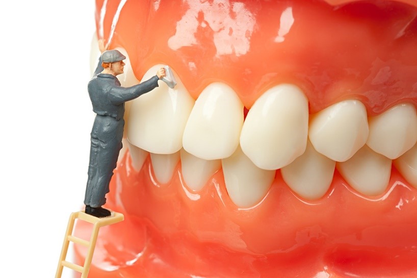 Top 4 dental cleanings in Advanced Smiles Dentistry