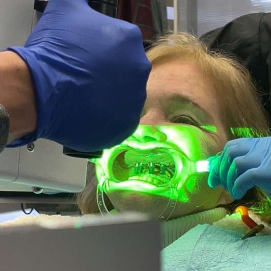 All on 6 implant dentures in Tijuana