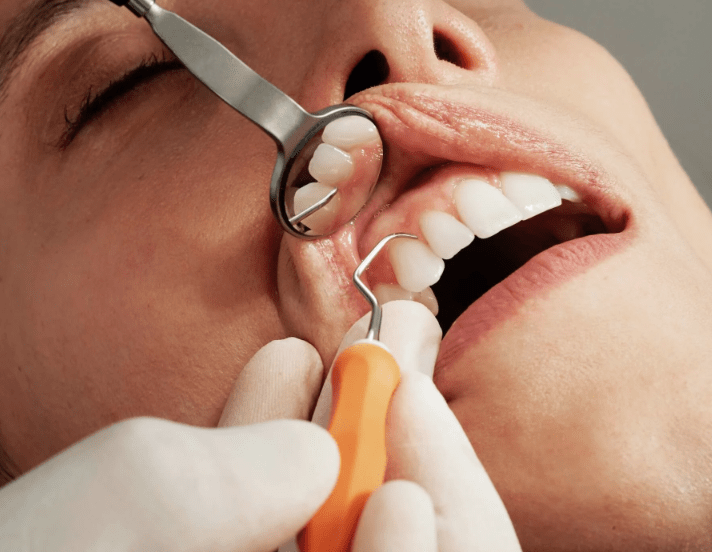 Preventive Dentistry: Avoid Tooth Decay and Root Canals