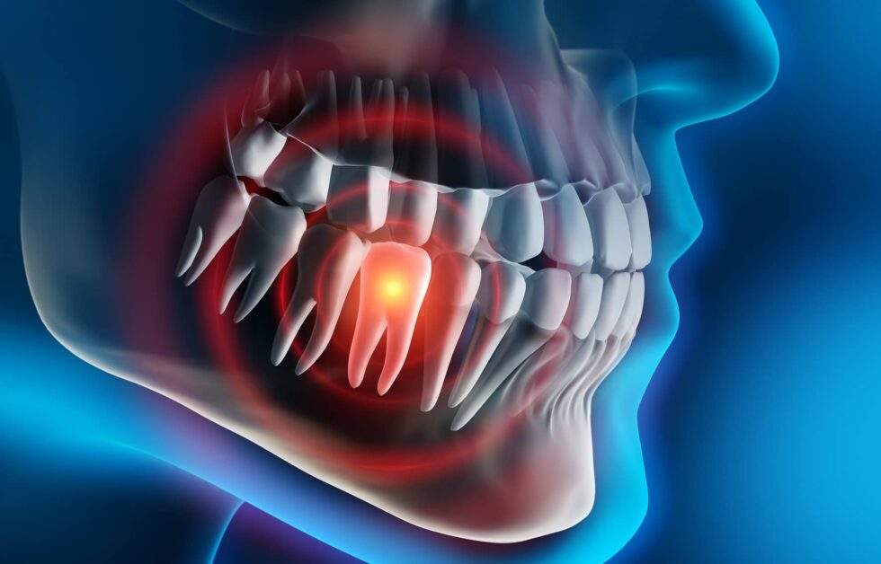 3-Things-Your-Toothache-Could-Mean