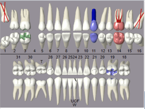 Affordable-Dental-Treatment-Plans