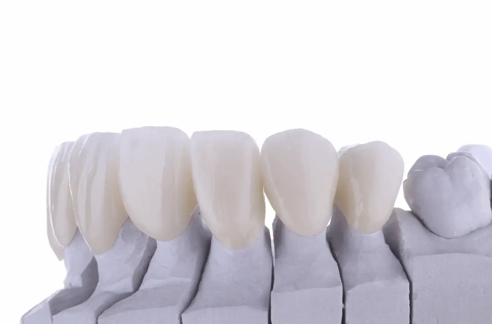 zirconia_dental-crown